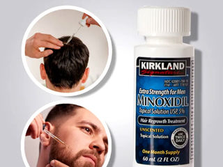 Minoxidil для роста волос. foto 2