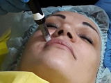 косметолог,дермапен ,миостимуляция,магнитно-роликовый баночный массаж foto 1