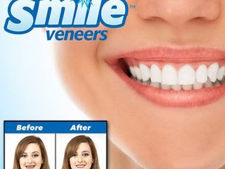 Улыбка на миллион долларов. Виниры на зубы Perfect Smile Veneers foto 3