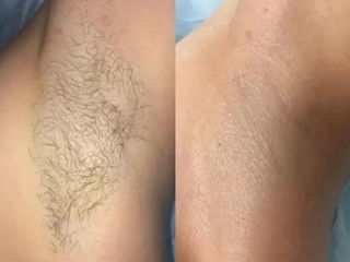Epilare sugaring/ceara sec. Buiucani foto 4