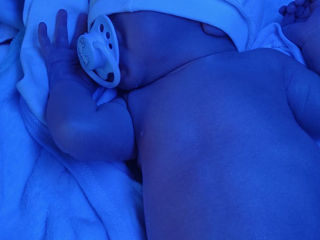 Лампа для малышей. Лечение высокого билирубина( желтуха). Аренда. Фотолечение на дому! foto 7