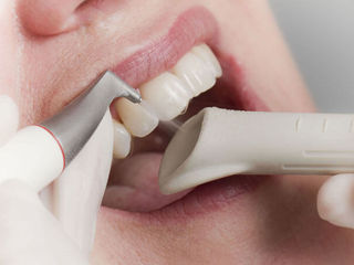 Технология производства стоматологического материала для профессиональной чистки зубов обмен на авто