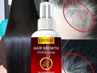 Спрей для роста волос и защиты от выпадения. Hair growth от бренда =Lidoria= foto 6
