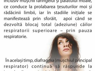 Diagnostic și tratament sforaitului și apneei de somn în Moldova Chișinău. Ajuta la slabire foto 5