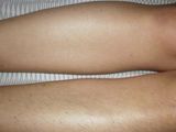 Epilare Sugaring ( zahar) Totalul la doar 400 lei foto 4