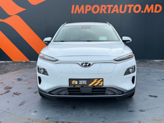 Hyundai Kona фото 3