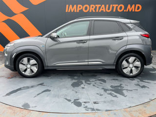 Hyundai Kona фото 8