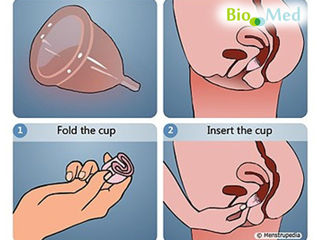 Cupa pentru ciclu menstrual кубок для mенструального цикла foto 3