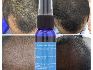 Сыворотка для лечения и стимулирования роста волос. foto 6