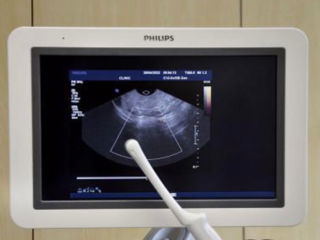 Philips iu22 сканер для ультразвуковых исследований. (узи). . foto 7