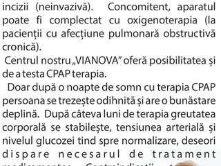 Diagnostic și tratament sforaitului și apneei de somn în Moldova Chișinău. Ajuta la slabire foto 9