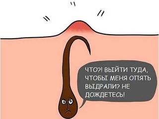 Электроэпиляция! Чеканы! foto 6