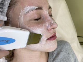 Tratamente faciale personalizate curățare facială / Cosmetolog Telecentru foto 1