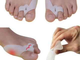 Лечебные фиксаторы для пальцев ног
