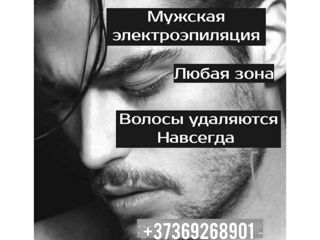 Мужская электроэпиляция/ Electroepilare pentru barbati/ Electroliza masculina/ Electrolysis for men foto 2