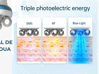 BIOPEN T6 (RF Lifting Facial+EMS+Masaj 360) foto 3