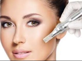 Mezoterapie fracționată/ Microneedling/ Dermapen