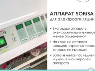 Electroepilator, folosit demult si o singura data.