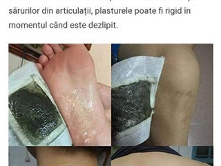 Plasture Detox / Ortopedic foto 4