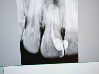 Echipament Radiologie Dentara foto 7