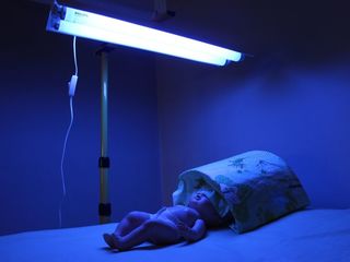 Лампа для лечения желтухи у малышей(высокий Билирубин).Lampa pentru scăderea bilirubinei. Очки! foto 8