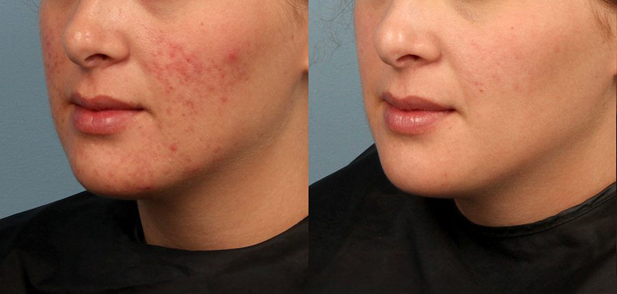 Prețuri pentru servicii de cosmetică în Chișinău! Salonul nostru de înfrumusețar Egoista foto 2