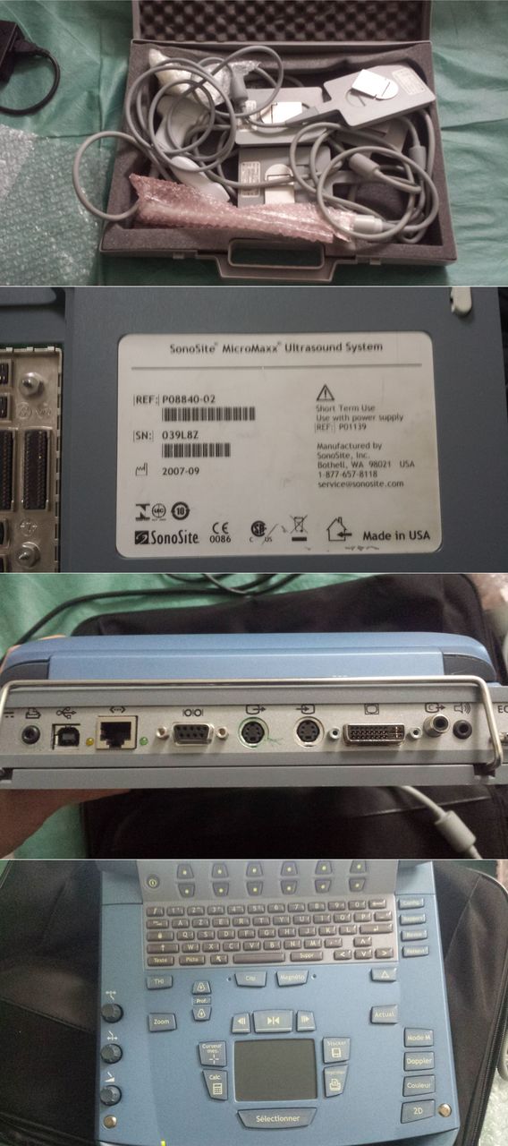 УЗИ сканер SonoSite MicroMaxx фото 1