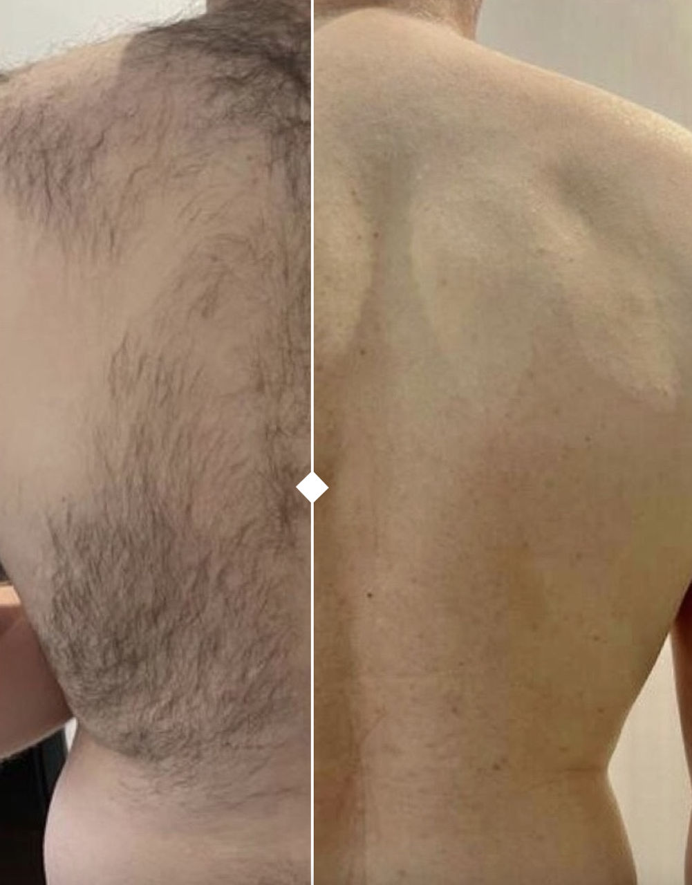 Лучший лазер для эпиляции в Молдове! Немецкое качество с Mediostar Monolith Asclepion Laser foto 3