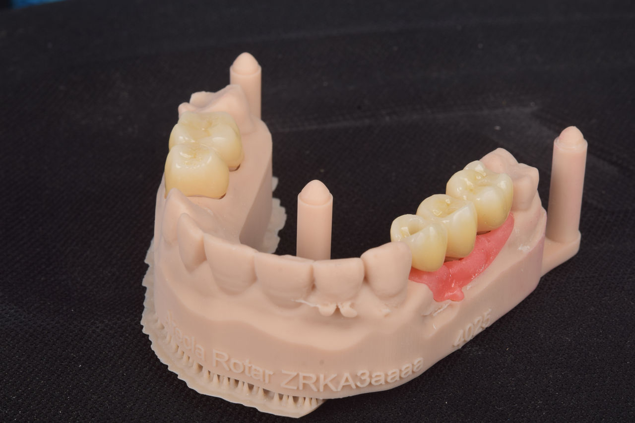  Implant dentar la pret adecvat.  foto 0