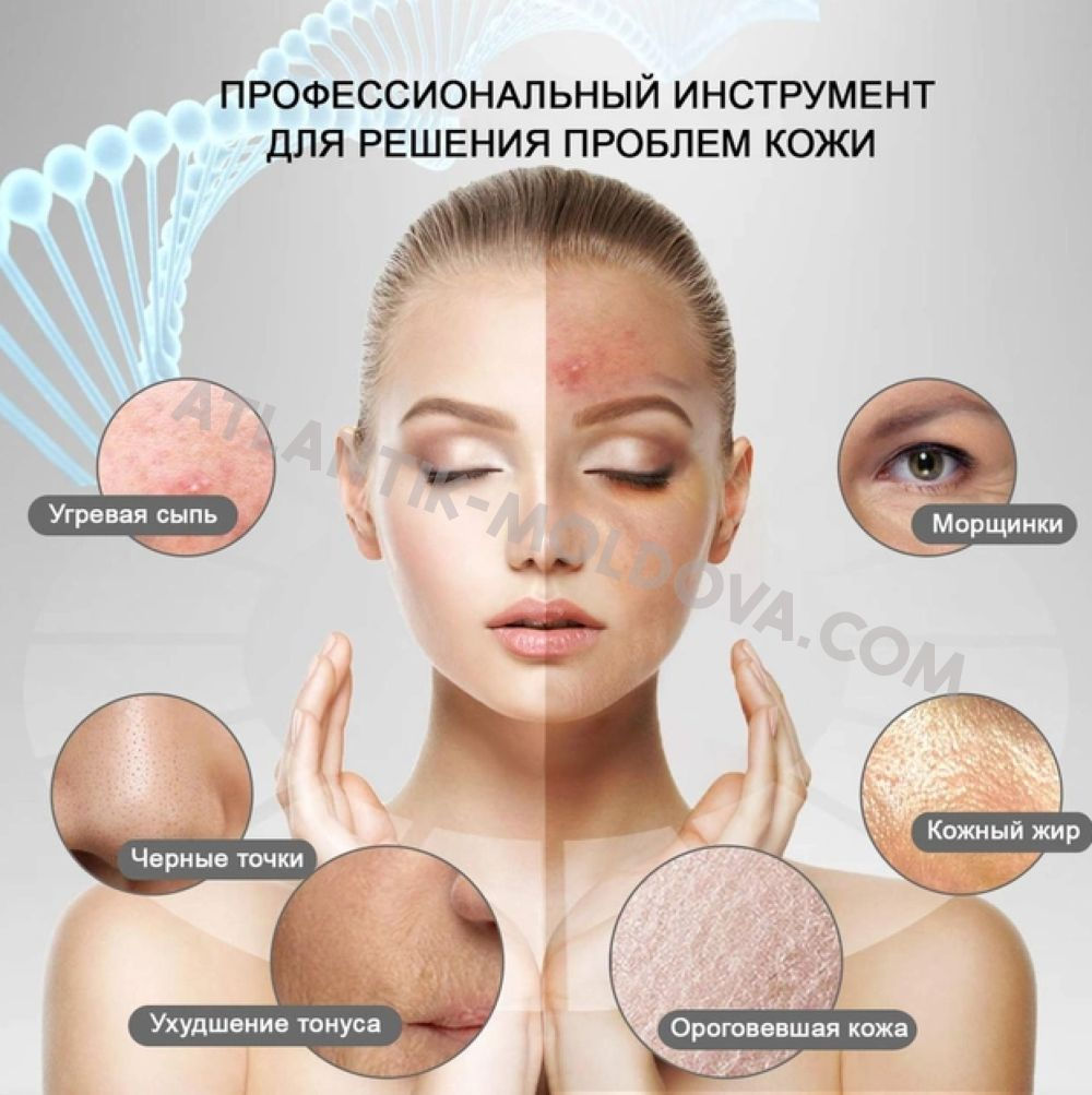 Профессиональный ультразвуковой аппарат для чистки лица. Бесплатная доставка фото 1