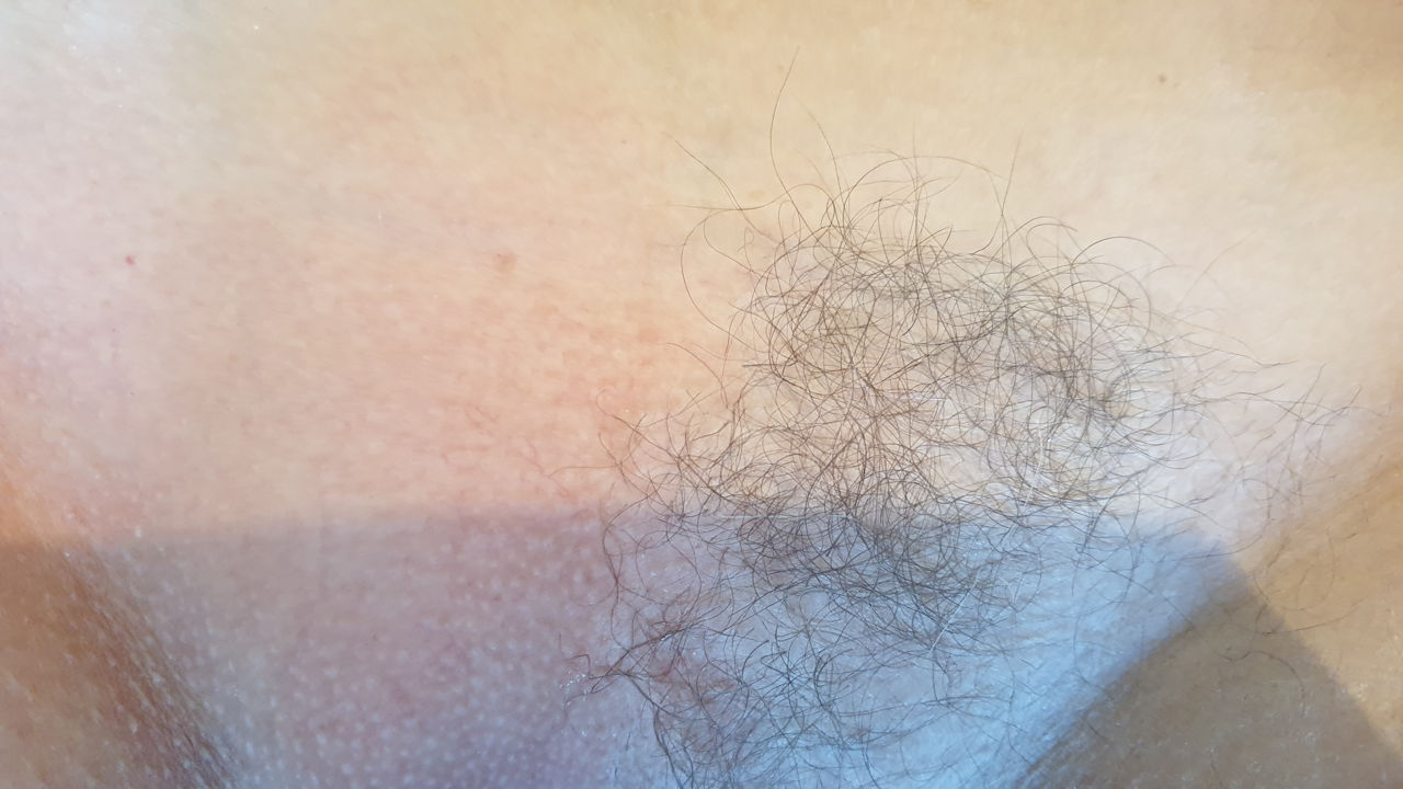 Sugaring - Epilare cu zahar,Ciocana foto 2