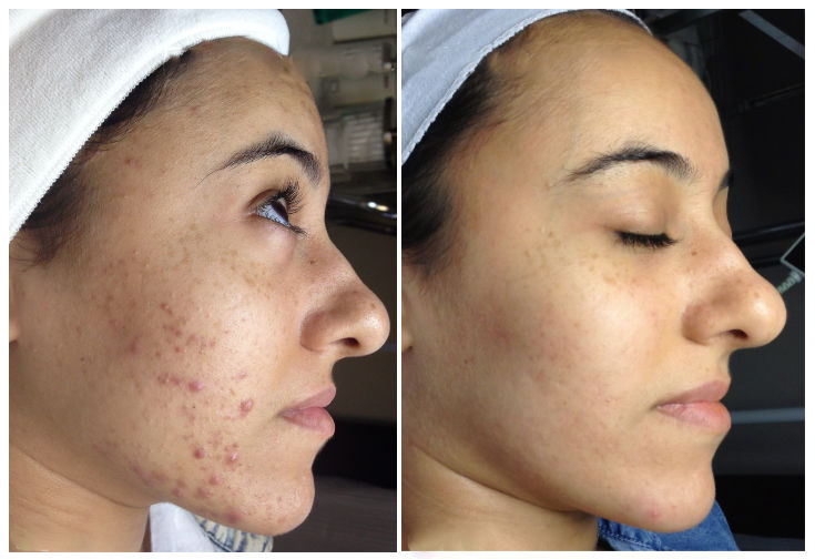 Prețuri pentru servicii de cosmetică în Chișinău! Salonul nostru de înfrumusețar Egoista foto 7