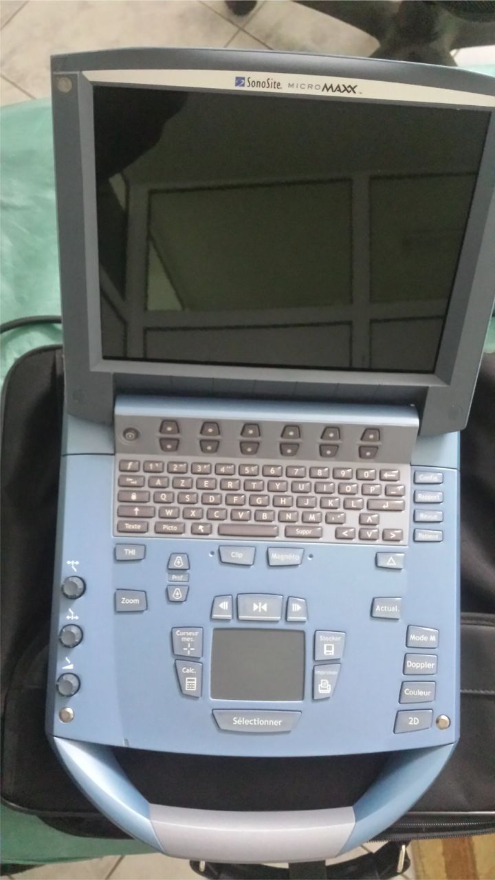 УЗИ сканер SonoSite MicroMaxx фото 0