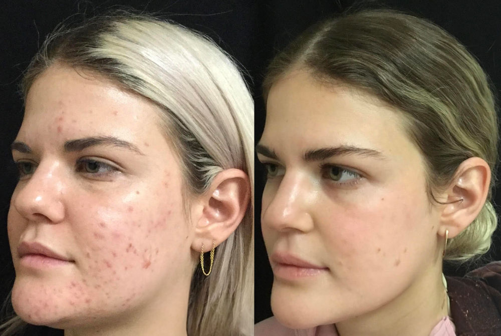 Prețuri pentru servicii de cosmetică în Chișinău! Salonul nostru de înfrumusețar Egoista foto 0