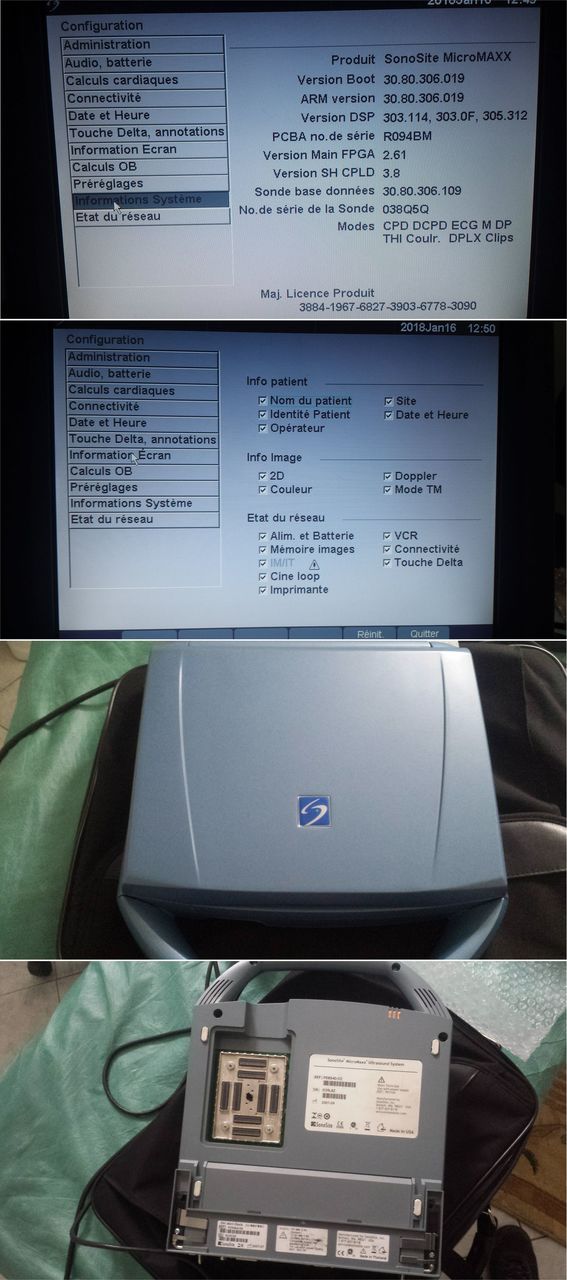 УЗИ сканер SonoSite MicroMaxx фото 2