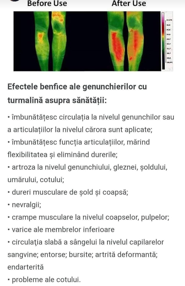 Genunchiere cu turmalină foto 8