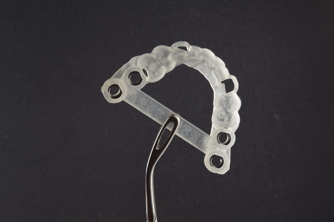  Implant dentar la pret adecvat.  foto 1