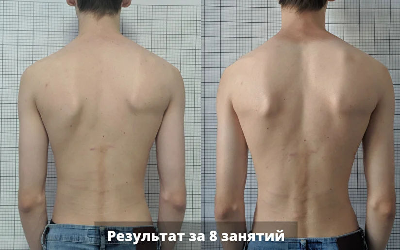 Врач выполняет 2 часа: массаж лечебный,вытяжение,массаж шея воротник,головы,лица,медовый foto 9