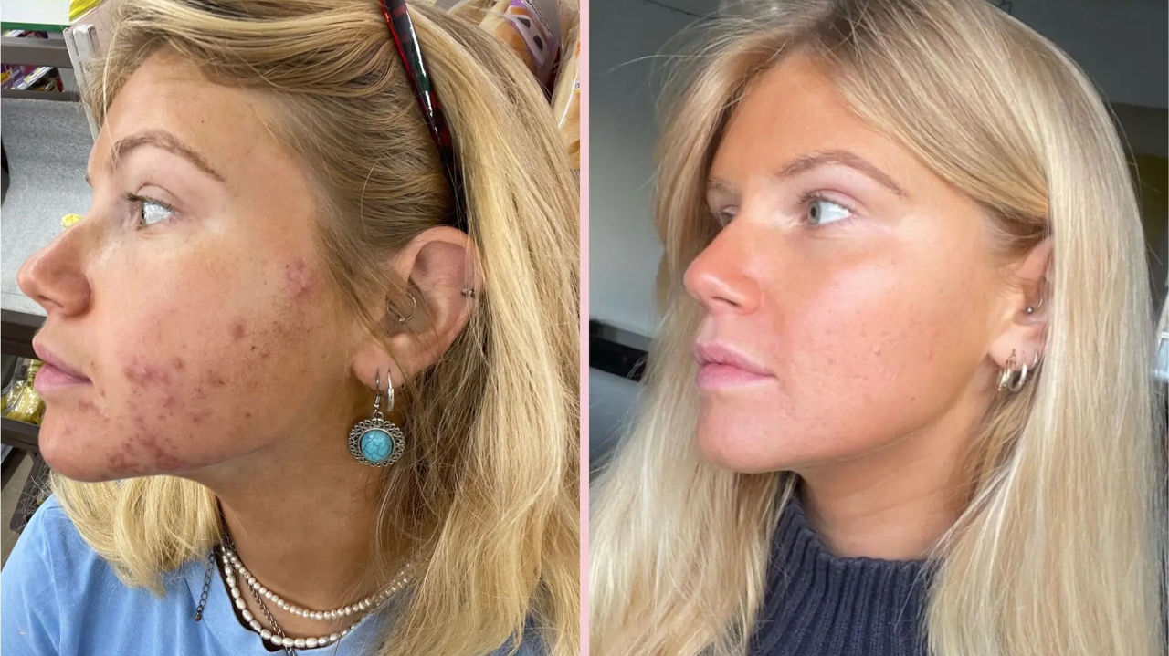 Prețuri pentru servicii de cosmetică în Chișinău! Salonul nostru de înfrumusețar Egoista foto 8
