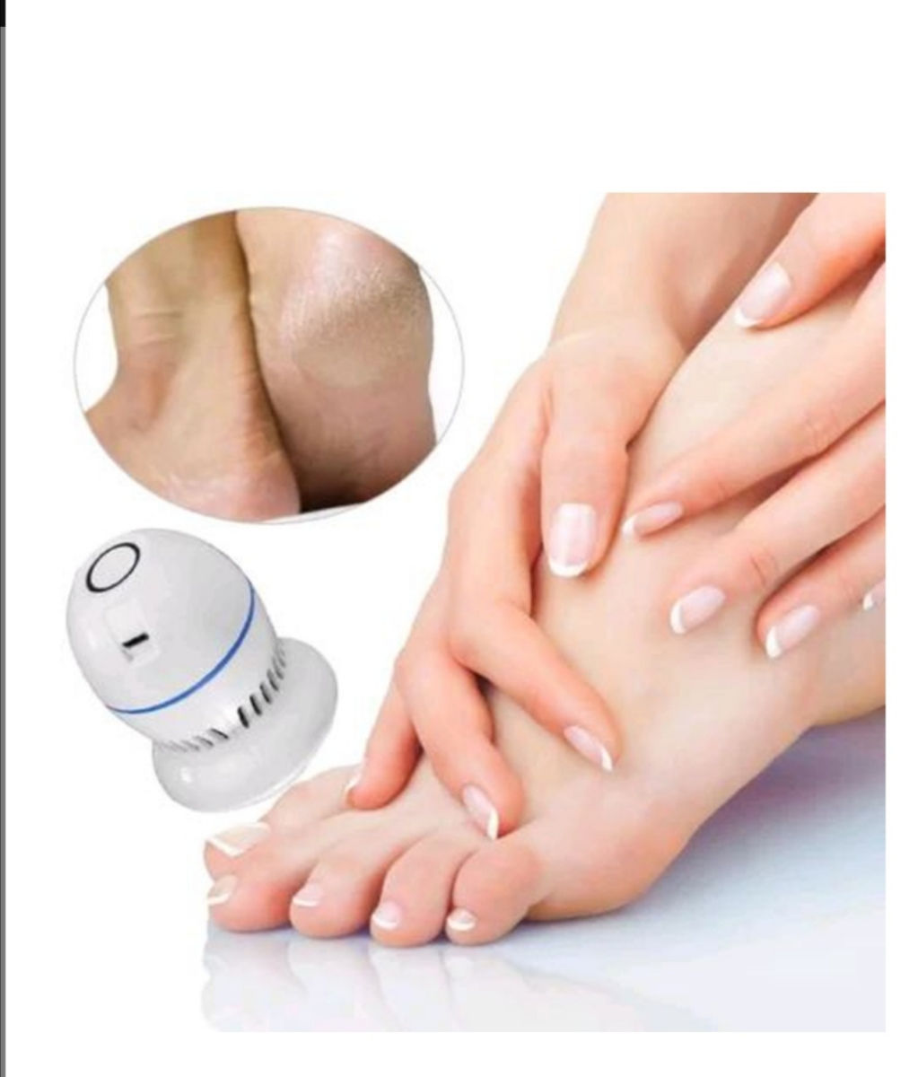 Срочно. Пемза для ног Pedi Vac Прибор для удаления мозолей фото 3