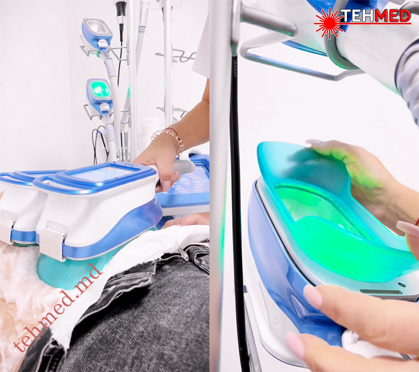 Аппарат для криолиполиза CRYO-360 Aparat de criolipoliză Cryolipolysis apparatus CRYO-360 фото 7