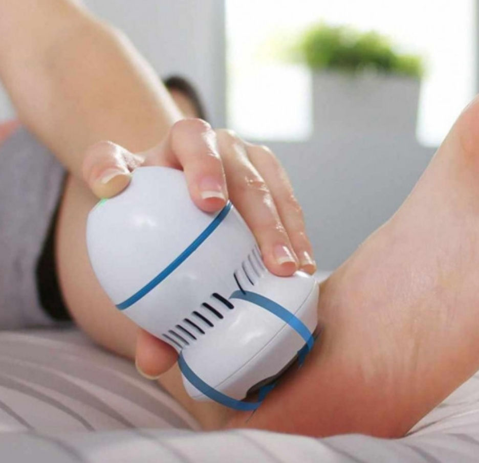 Срочно. Пемза для ног Pedi Vac Прибор для удаления мозолей фото 2