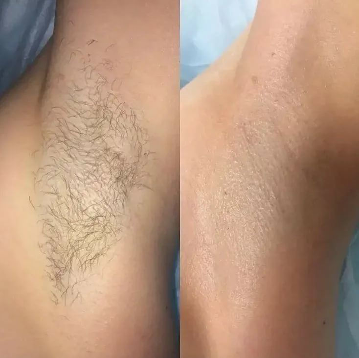 Epilare sugaring/ceara sec. Buiucani foto 4