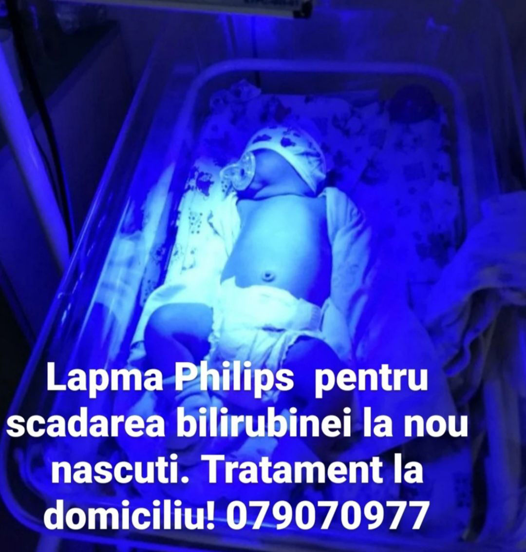 Laрma pentru scaderea bilirubinei la nou nascuti. Аренда лампы. Лечение желтухи на дому! Очки! foto 7