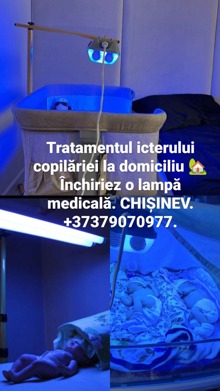 Închiriază o lampă Philips dublă certificată medical pentru tratamentul icterului la bebeluși acasă! foto 3