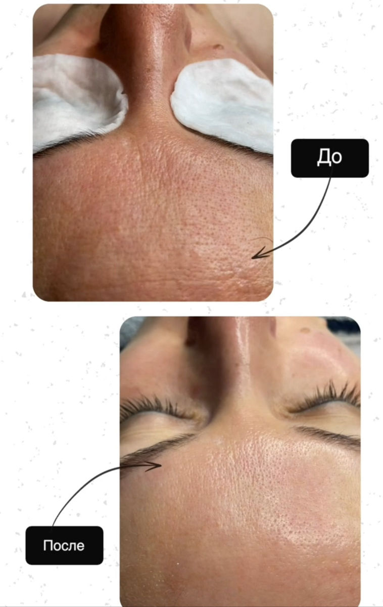 Cosmetolog cu studii medicale фото 6