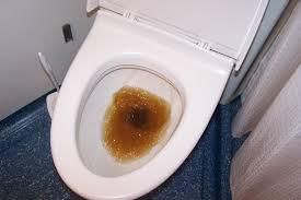 Desfundare canalizare  bucatarie,wc,baie,dus 24/7,in apartament,case,1 ora. Inlaturare scurgeri tevi foto 1