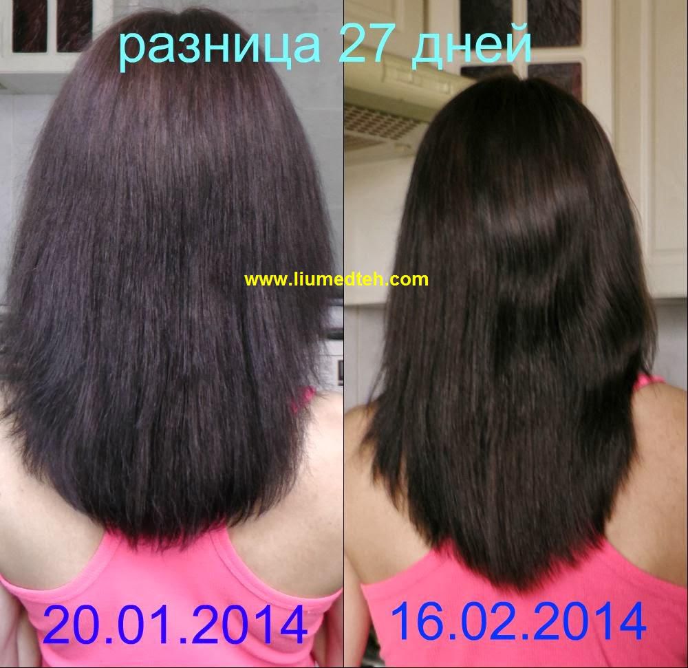 Волосы до и после эсвицина