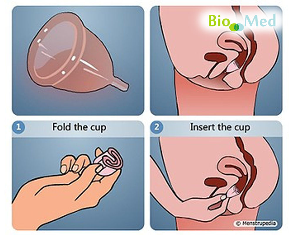 Cupa pentru ciclu menstrual кубок для mенструального цикла foto 3