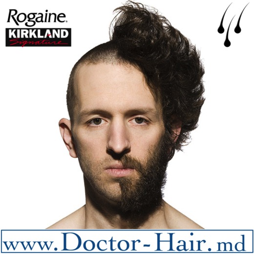 Minoxidil Kirkland - pentru barba foto 3